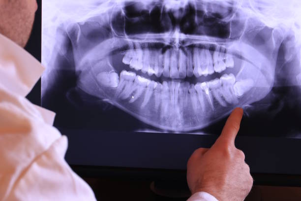Best Broken or Cracked Tooth Emergency Dentist in Sunray, TX