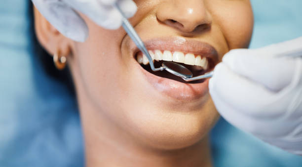 Best Emergency Root Canal Treatment in Sunray, TX